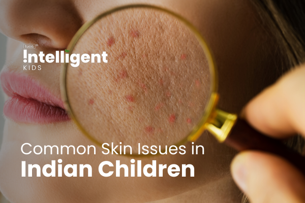 Understanding Common Skin Issues In Indian Children: Causes And Soluti 