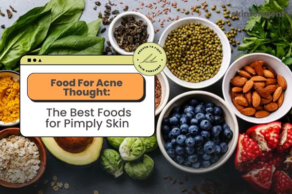 Food For Acne Thought: The Best Foods for Pimply Skin